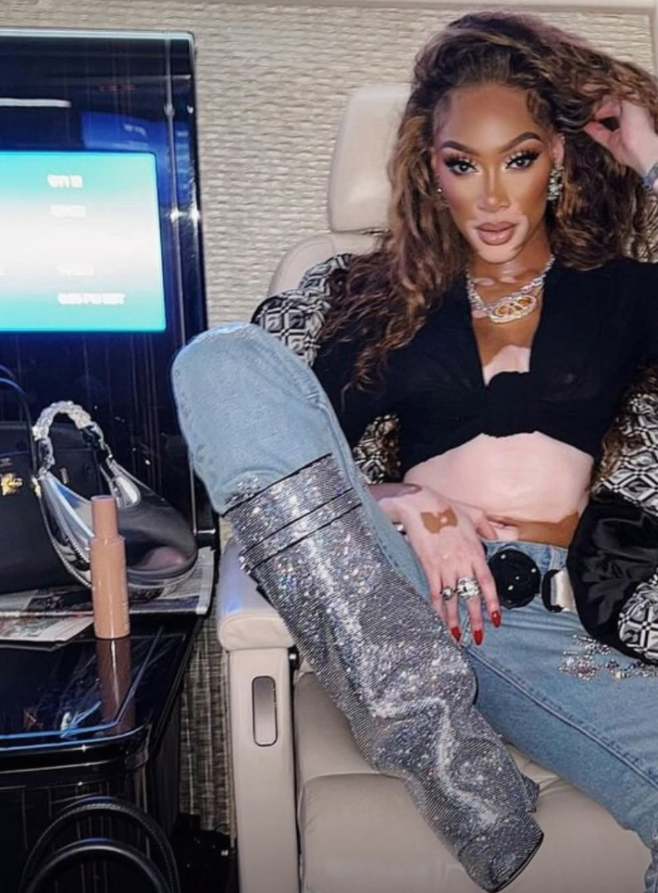 A woman with vitiligo and long, wavy brown hair sits in what appears to be a private jet, wearing a black top, light-wash jeans, and sparkling, knee-high silver boots. She is looking directly at the camera with one hand near her hair. In the background, a screen and a black handbag are visible on a table.
